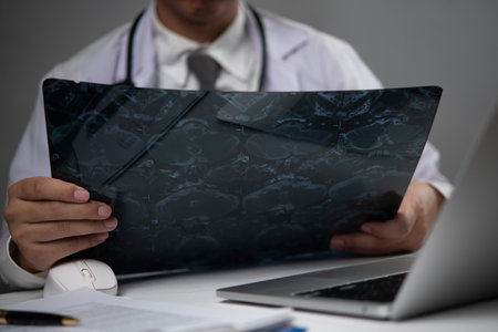Doctor looks at X-ray film, examines brain scan, MRI, health careの写真素材