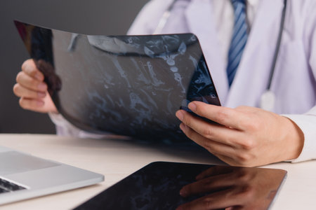 Doctor working with medical imaging and technology to provide accurate diagnosis. Ideal for hospitals, patient care, and healthcare professionals. doctor diagnosing brain problems using x-ray films.の写真素材