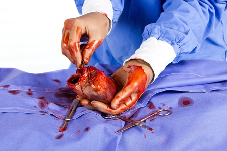 Doctor operating on patient heart in blue with toolsの写真素材