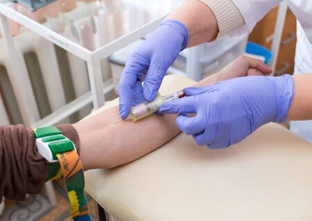 blood sampling from a veinの写真素材
