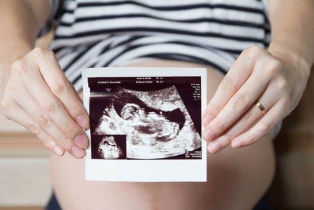 Close up of holding ultrasound scan of pregnant woman