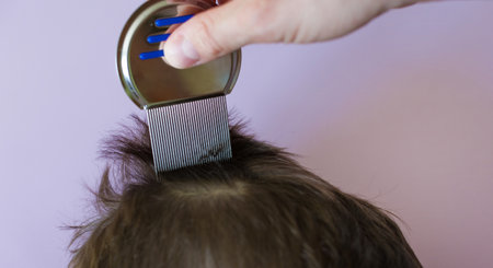 Lice comb and brunette hair on a violet background with copy space. Man using nit comb on childs hairの写真素材