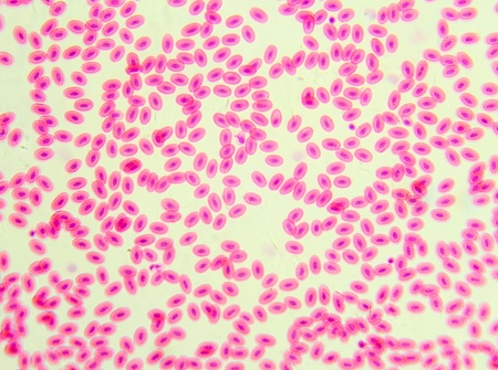 Blood pigcon under the microscope, background   Columba livia の写真素材