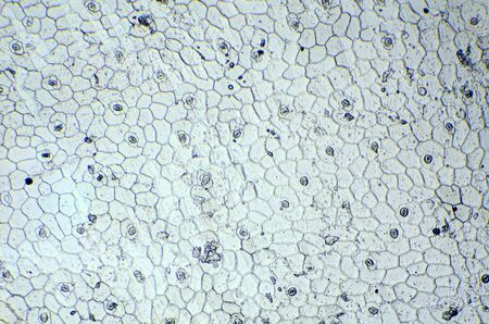Kalanchoe under the microscope, background   Kalanchoe 