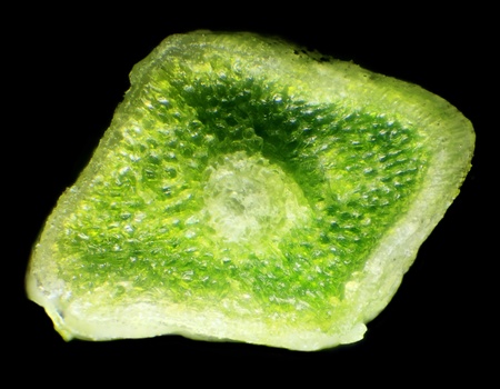 spruce needles under the microscope   Picea 