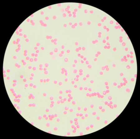 Human blood under the microscope (Blood Smear Human) 400x
