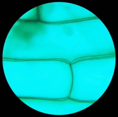 Rhode flagellate protozoa under a microscope (Allium Scale Euglena W.M.), 1000x