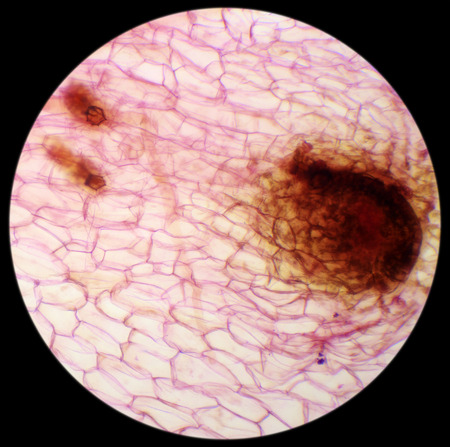 Micrograph of new sporophyte of fern leaf prothallium, background (Fern Prothallium W.M.)