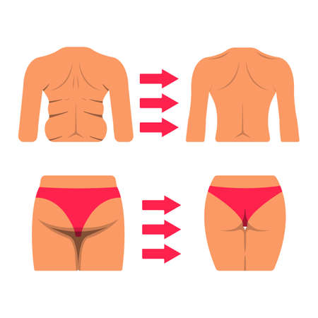 Set of White Woman Body Part. Fat and Sporty Body Icon. Vector Illustration Label.のイラスト素材
