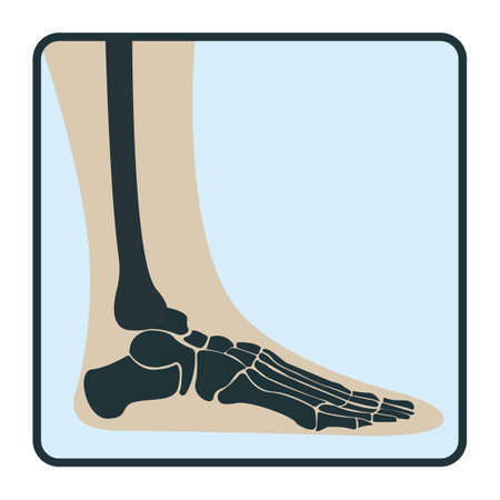 Leg bone, x-ray concept icon, roentgen human body image isolated on white, flat vector illustration. Skeleton part of man organism, silhouette black biological science.のイラスト素材