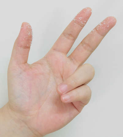 Open Empty Hand Reaches Out with White Sugar on Fingers Against on White Background.の写真素材