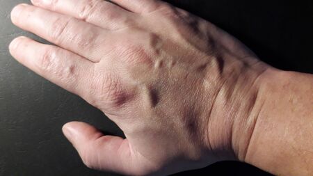 Hand of a man in various states on a black the background