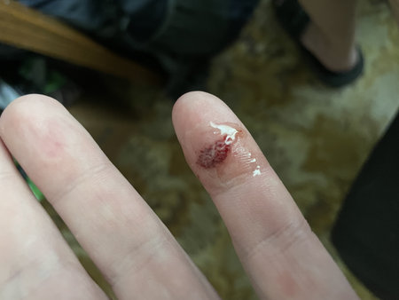 Close up of a small finger with a fresh cut caused by a sharp kitchen knife.