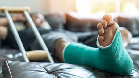 Bone fracture foot and leg on male patient with splint cast and crutches during surgery rehabilitation and orthopaedic recovery staying at homeの写真素材