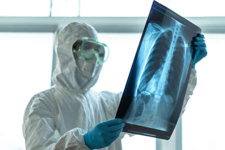 COVID-19, Coronavirus or Novel corona virus epidemic disease with doctor or lab technician scientist...