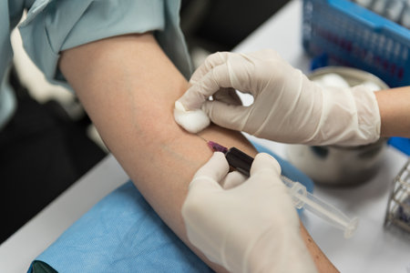 Nurse doing blood test in laboratory. Blood test in laboratory.の写真素材