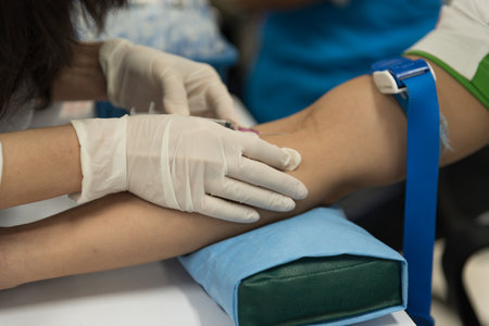 Blood donation, blood transfusion in hospital, blood transfusion conceptの写真素材