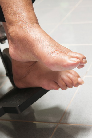 Close-up of Skin old woman on the wheel of a wheelchairの写真素材
