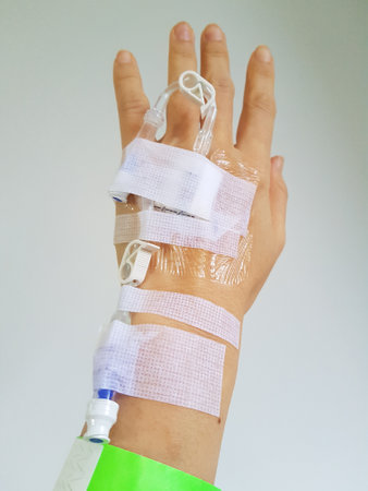 The hand of a patient in the hospital whose IV line was pierced. For treating illnesses, IV lines, injection lines that are drilled into the hands of patients in hospitals.の写真素材
