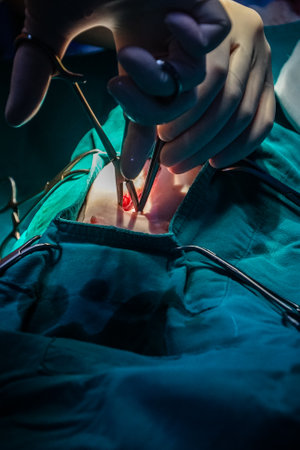 Abdominal surgery for cats to treat various injuries and cesarean sections.の写真素材