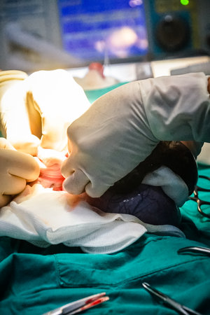 Doctor's hands and medical equipment during surgery.
