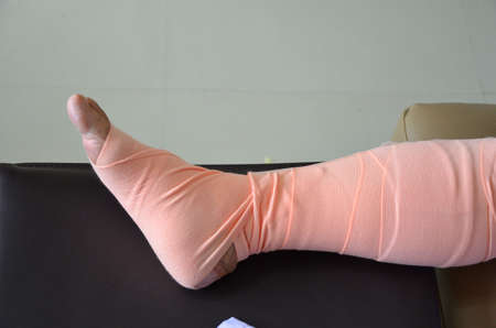 Hurt leg wrapped with elastic bandage の写真素材