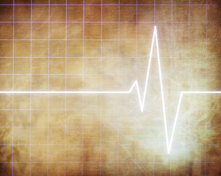 Heart beat on hospital monitor