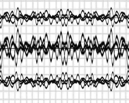 brain waves on a solid white background