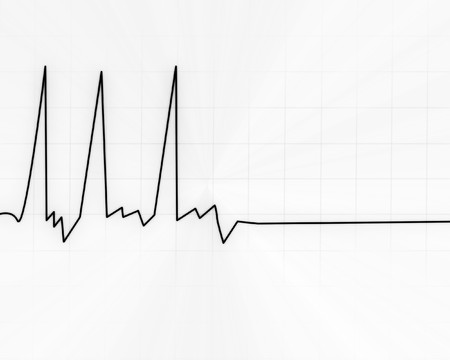 earth quake lines on a white backgroundの写真素材