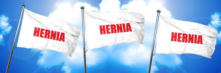 hernia, 3D rendering, triple flagsの写真素材