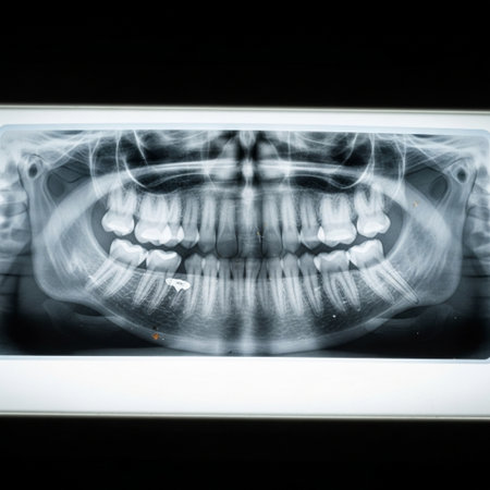 Dental x-ray image of a patient's teeth and gums.の素材