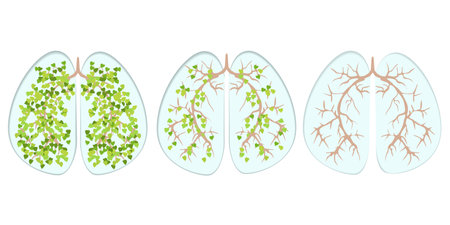 A person's breath to his lungs and respiratory system. example of healthy and diseased organsのイラスト素材