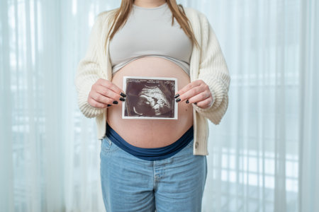 Pregnant woman holding ultrasound scan photo of a fetus in front of her belly in third trimester at home. Concept of pregnancy, sonography. Maternity prenatal careの写真素材