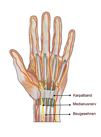 carpal tunnelの写真素材