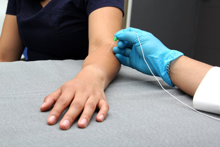 Electromyography is a graphic recording technique of the electrical activity of the muscles known as electromyogram or EMG, it is monitored through intramuscular electrodesの写真素材