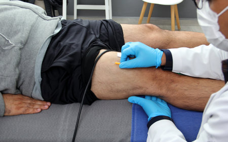 Electromyography EMG and Somatosensory Evoked Potential PEV of lower extremities, neurophysiological...