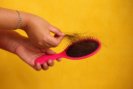 Woman's hands take a hairbrush with many fallen hairs after brushing for alopesia, anemia or postpartum diseaseの写真素材