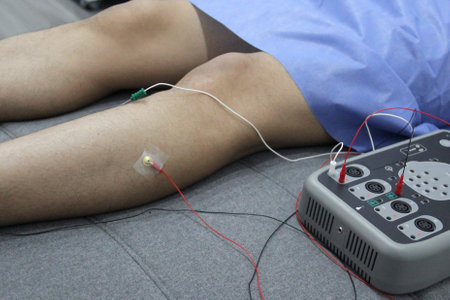 Electromyography and somatosensory evoked potentials in the legs of a young adult patient in the...