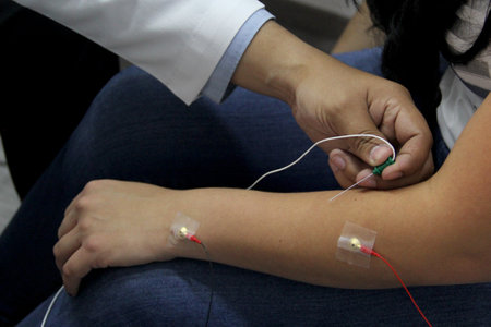 Electromyography and somatosensory evoked potentials are neuropsychological tests that evaluate the...