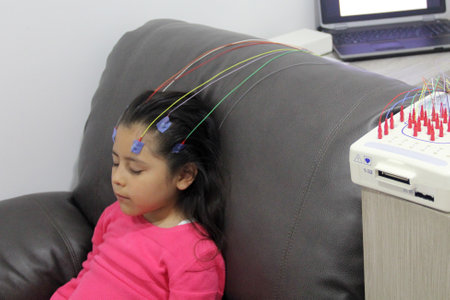 Electroencephalogram, a test that measures the brain's electrical activity, recording the brain...