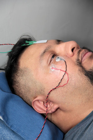 Electromyography EMG and facial nerve conduction velocity NCV to assess nerve damage from facial...
