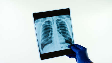 Medical radiography of thorax. Light background.