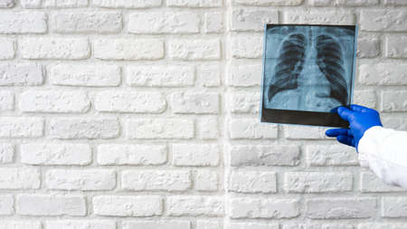The doctor examines the chest in the picture. X-ray of the lungs in the hands of a doctor against...
