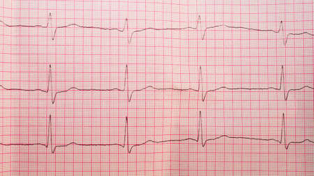 Human heart cardiogram close up copy space.