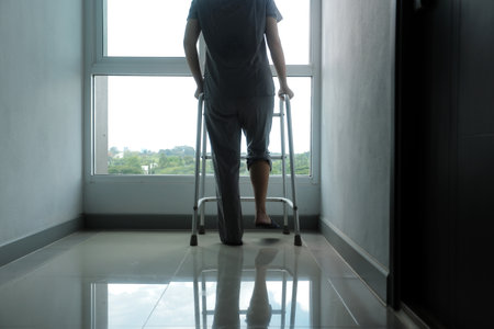 Physiotherapist is doing physical therapy for a patient, the patient has body aches due to overwork and has undergone treatment and physiotherapy with a professional physiotherapist.の写真素材