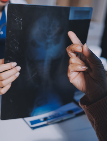 The doctor explain the old lady in retired life patient on lungs x-ray film and discuss treatment method to patient in hospital nursing home aged care by using health and life insurance planningの写真素材