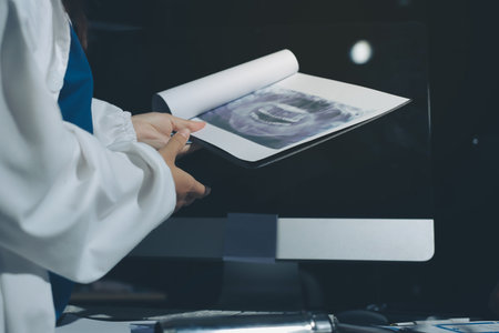 Two doctors and a female nurse meet at a table in the hospital, collaborating on medical tasks using laptops and computersの写真素材