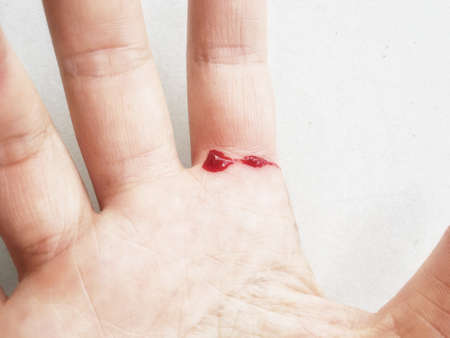 finger on right human hand was cut and bleeding with red blood from fresh woundの写真素材