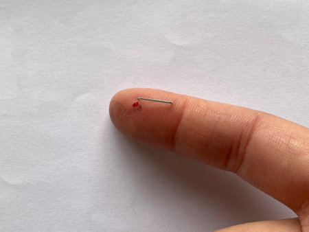 finger on right human hand was prick by staples and bleeding with red blood from fresh woundの写真素材