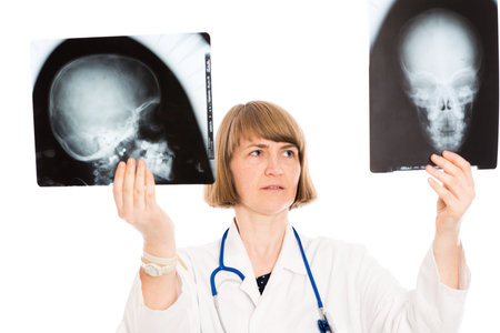 young female doctor with X-ray photograph in front of white backgroundの写真素材